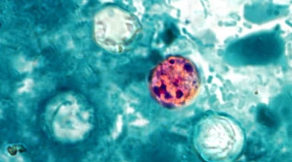 San Diego, California dodge cyclosporiasis outbreak as FDA focuses on shredded lettuce as culprit