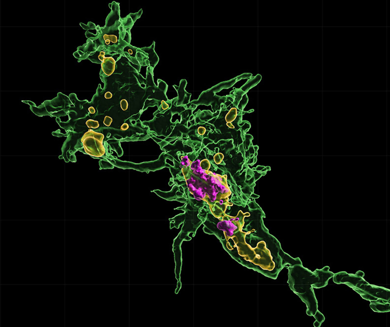 Salk Institute researchers make progress on ALS and autoimmune disease treatments